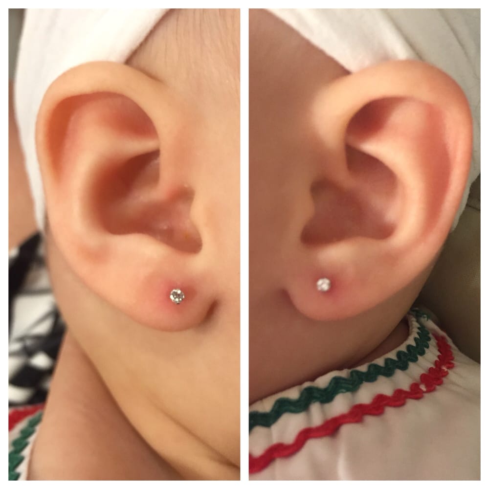 Infected ear piercing videos